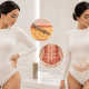 Tummy Tuck vs. Liposuction: Which Is Right for You?